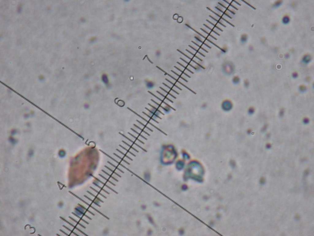 Cylindrobasidium laeve o evolvens ??(Cylindrobasidium laeve)